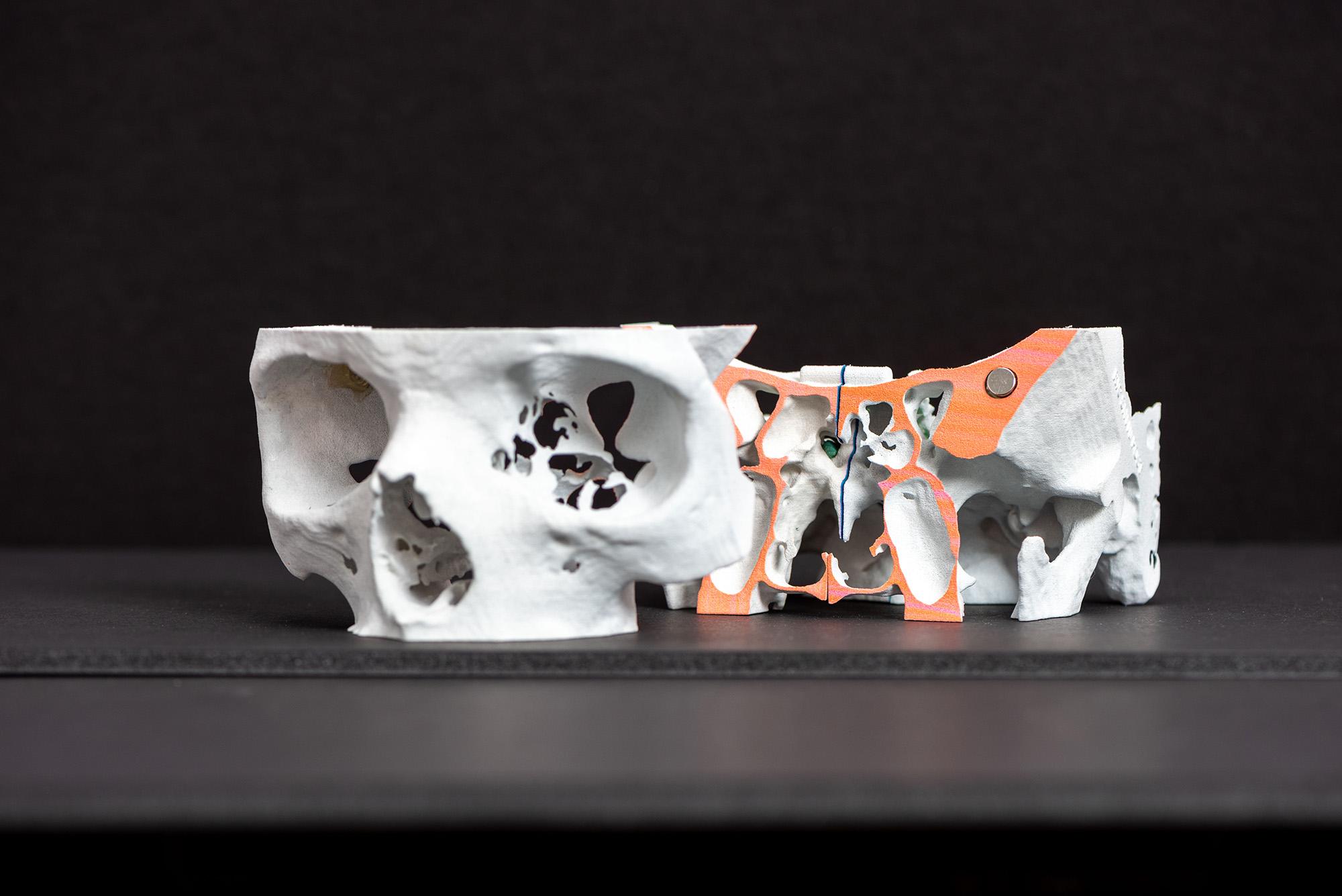 5 Applications - How 3D Printing Change the Medical Industry